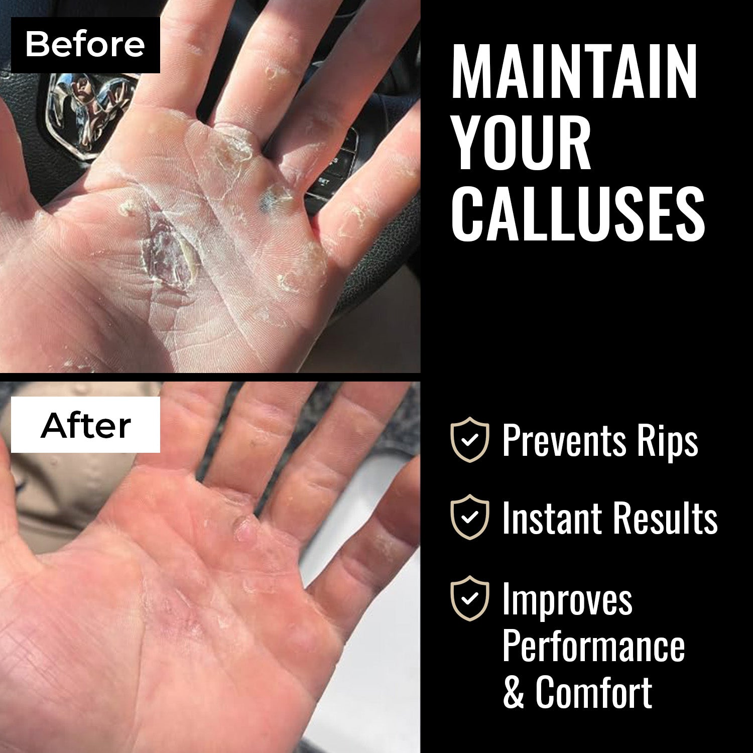 SandBar 8" Gymnastics Callus Care Kit